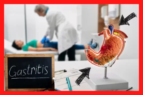 Cómo combatir la gastritis